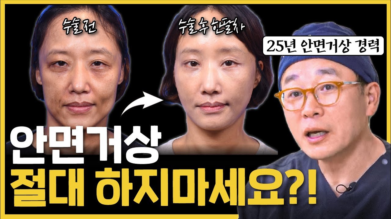 주름보다 무서운 건 ‘잘못된 안면거상 이라는 사실!  실패 없는 안면거상 핵심 4가지
