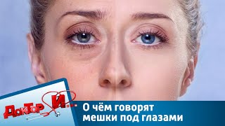 О чём говорят мешки под глазами | Доктор И