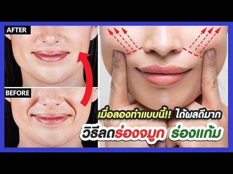 ได้ผลดีมาก!! วิธีลดร่องปีกจมูก ร่องจมูกลึก ร่องแก้ม ลดอายุ หน้าไม่แก่ก่อนวัย (ไม่ฟิลเลอร์ ไม่โบท็อก)