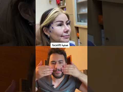 مشاكل عمليات التجميل دكتور يوسف