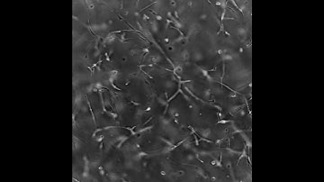 Time Lapse Video of MSC in a PEG-Fibrinogen Hydrogel