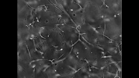 Time Lapse Video of MSC in a PEG-Fibrinogen Hydrogel