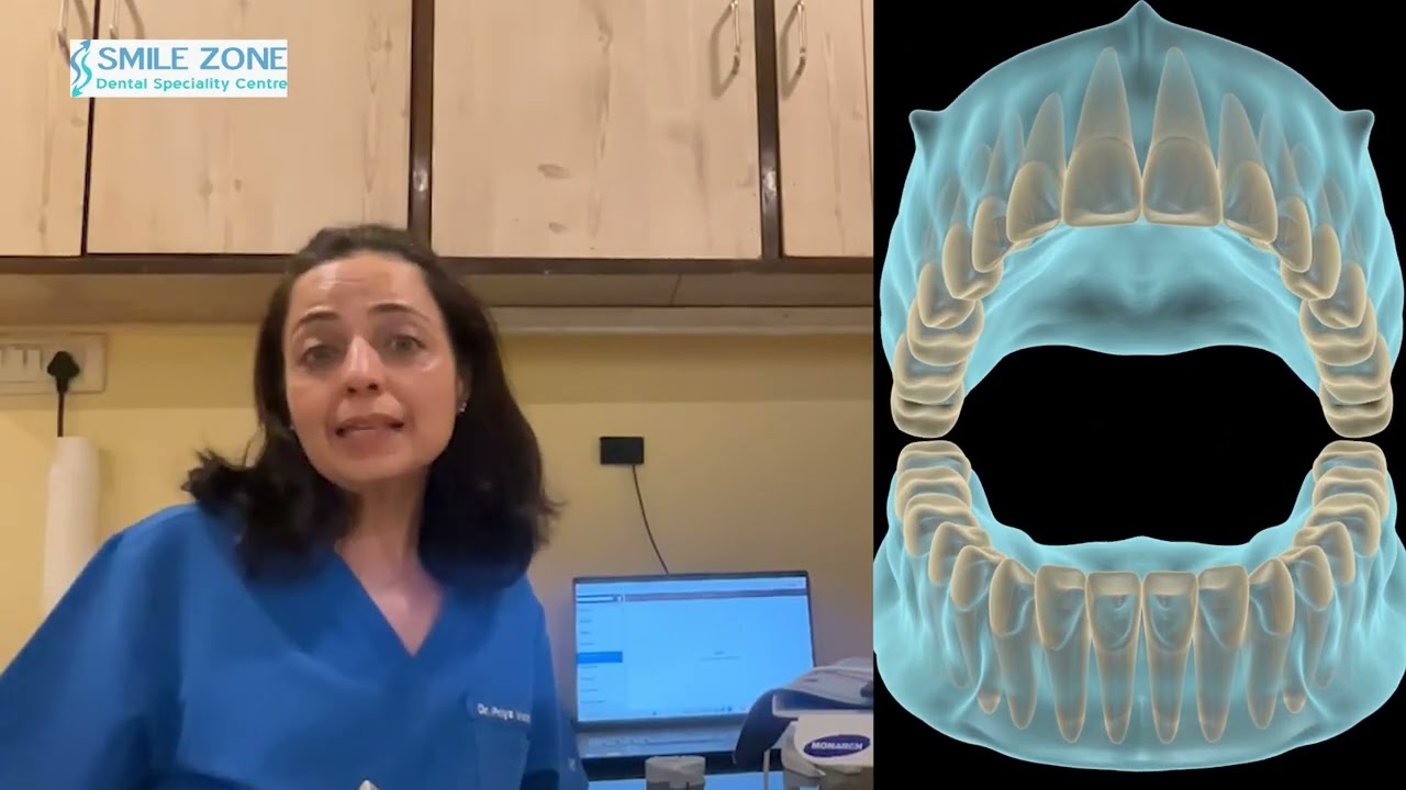 Still Using Messy Dental Impressions? 😊 | Digital Dentistry Whitefield | AI Smile Scanning