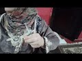 حقنه عضل جديدة النهاردة للأعصاب
