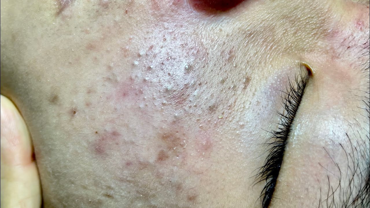 Satisfying video with Chung Vo Spa | 254