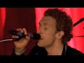 Coldplay are Shit