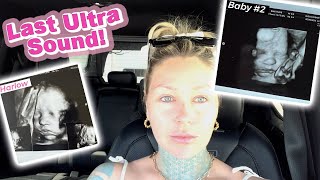 The LAST Ultrasound | KristenxLeanne