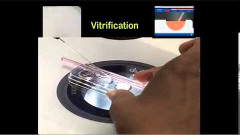 Vitrification Warming Kit Use in IVF Lab