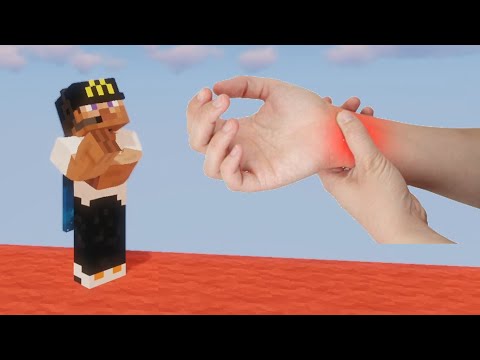 carpal tunnel