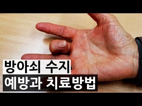 방아쇠 수지 예방과 치료방법 #24