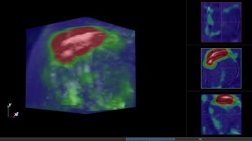 Class activation map change while training 3D CNN