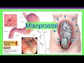 misoprostol
