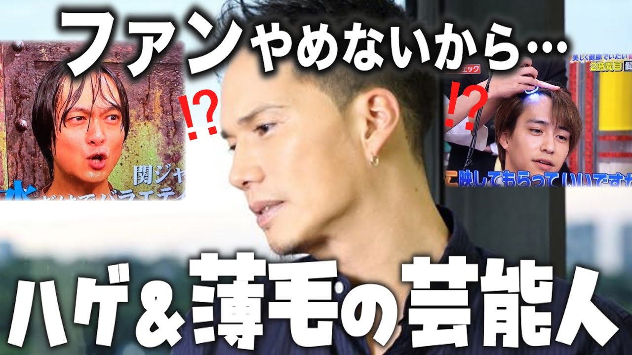 ファンやめないから…ハゲても大好きな芸能人を紹介します【ガルちゃん芸能・2ch有益】