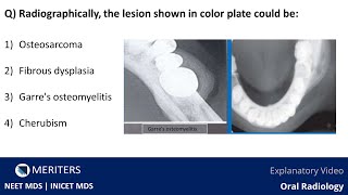 NEET MDS | INICET - Oral Radiology | Explanatory Video | MERITERS screenshot 3