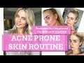 Acne Skin Care Routine: Favourite Products