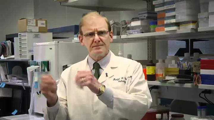 Pancreatic Cancer Sequencing Project: Dr. Hruban