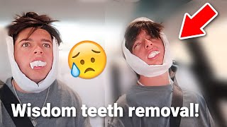 Identical TWINS Get Their WISDOM TEETH Out! (Hilarious Reaction)