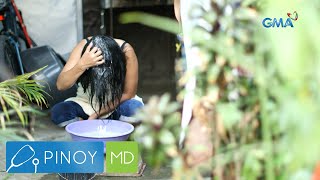 Balakubak, Paano Ba Tuluyang Mawawala? Pinoy Md