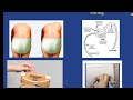 Scoliosis for the FRCS Orth exam