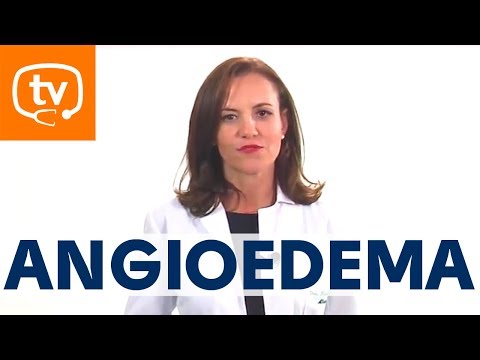 Vídeo: Angioedema: Sintomas, Tratamento, Causas, Diagnóstico