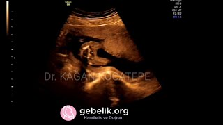 16 haftalik 3 5 aylik kiz bebek ultrason goruntuleri bebegin kilosu ve boyu ne kadardir youtube