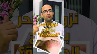 علاج الصدفية بالبحر و الشمس - هل بيجيب نتيجة؟ ? #دكتور_ايمن #doctor_ayman #الصدفية