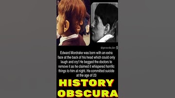 Edward Mordrake Born With 2 Faces #History #Facts