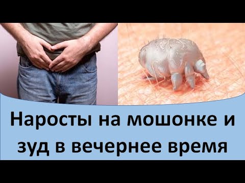 Наросты на мошонке и зуд в вечернее время