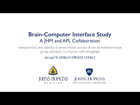 Brain-Computer Interface Study | Characteristics and Stability of Sensorimotor Activity