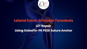 Lateral Extra-Articular Tenodesis (LET) Repair | OsteoFix-PK PEEK Suture Anchor | Knee Arthroscopy