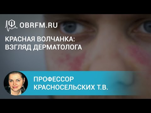 Video: Парестезия кызыл желекпи?