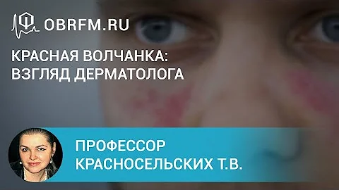 Профессор Красносельских Т.В.: Красная волчанка: взгляд дерматолога