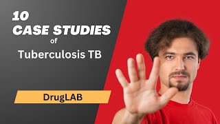 Tuberculosis TB: 10 Case Studies In-Depth Case Studies and Treatment Strategies #diabetes #DRUGLAB