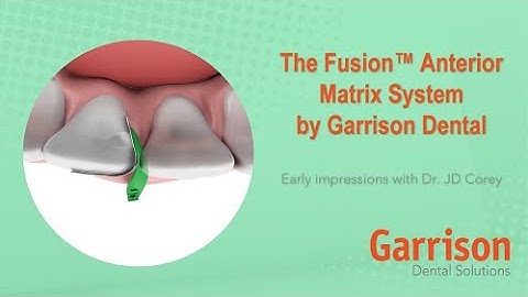 First Impressions of the NEW Fusion Anterior Matrix System with Dr. JD Corey