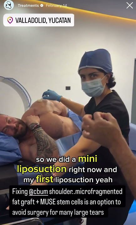 Healing Tendon Injuries with MUSE Cells and Fat Grafting: A Regenerative Approach #shorts