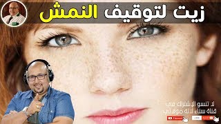 زيت لتوقيف النمش والتخلص من الهالات السوداء