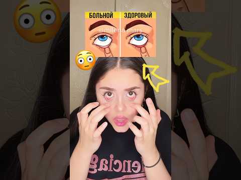 Это Не Лечится..😭До Конца💔#shortsviral #shortsvideo #shorts #milemamars #а4 #глаза #music #шортс