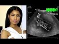 Nicki Minaj Performance to Open 2015 MTV VMA's