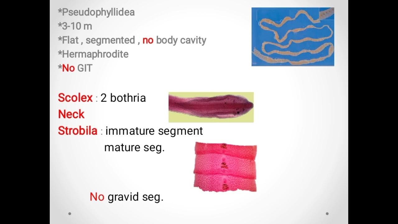 Diphyllobothrium Latum(broad fish tapeworm) ديدان السمك الشريطية YouTube
