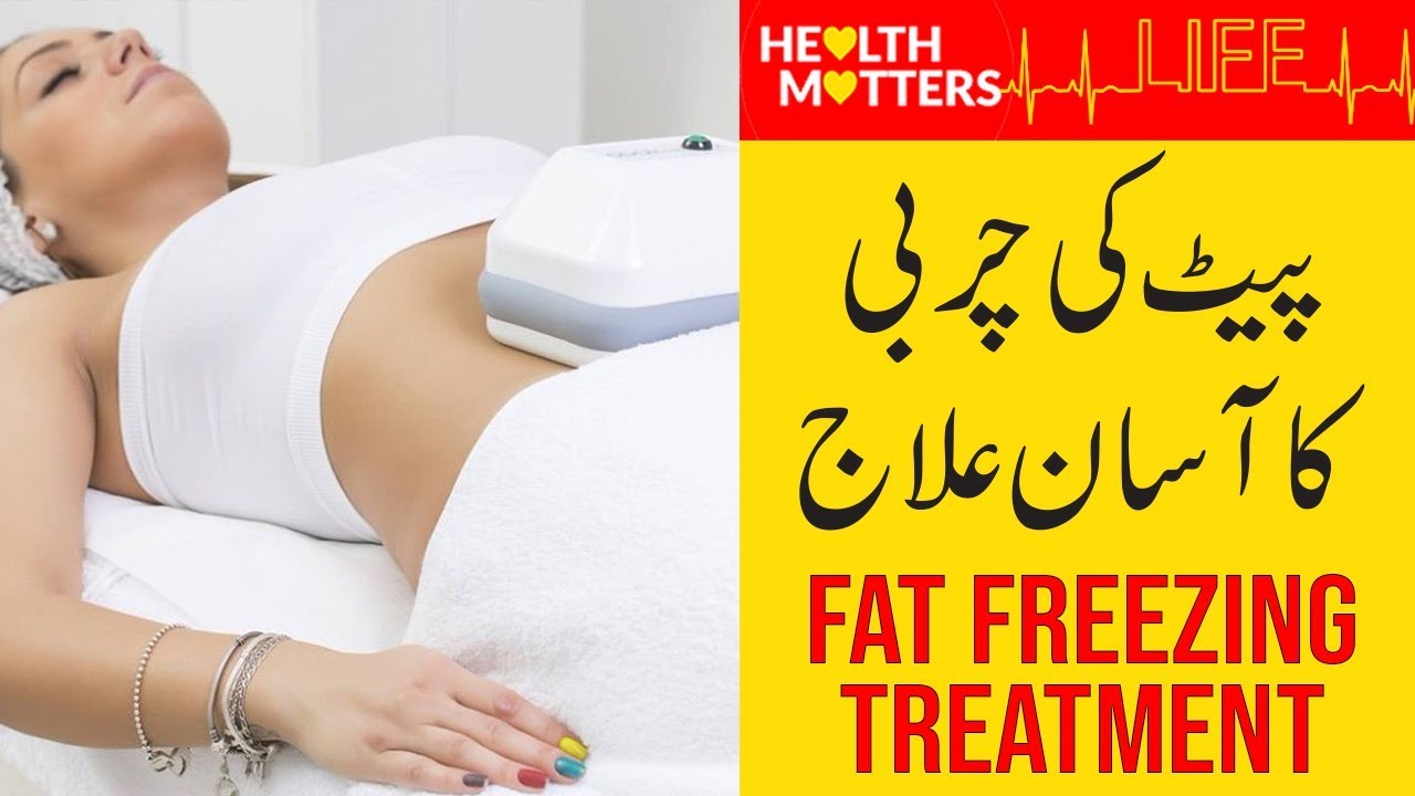 What is Fat Freezing Treatment | Pait Kam Karne Ka Asan Ilaj | Dr Hassan Dawood