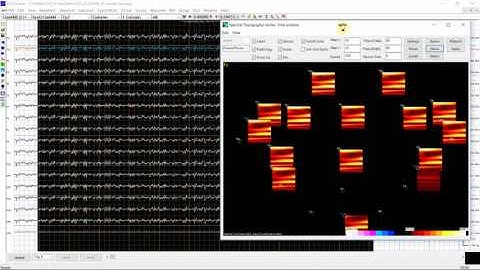 MEG/EEG Time Frequency Analysis 07