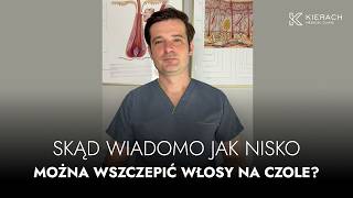 Skąd wiadomo jak nisko można wszczepić włosy na czole?