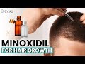 Minoxidil For Hair Growth | Minoxidil | How does Minoxidil work | Minoxidil Uses | Uroots #qht