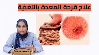 علاج قرحة المعدة بالتغذية - د. اروه عبد الرحمن | عيادة الخليج