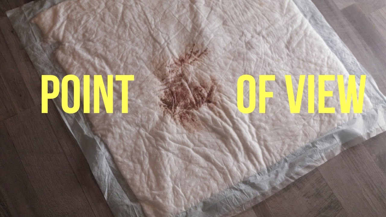 I had an accident and I made ART out of it - Artist Life Journey