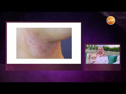 الصابون والليف المناسب لإسمرار الإبط ومرضى الصدفية والإكزيما هي وبس