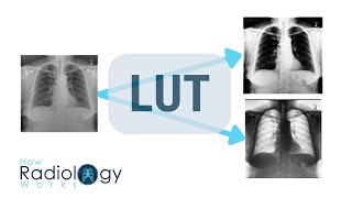 LUTs (Look Up Tables in Radiology)