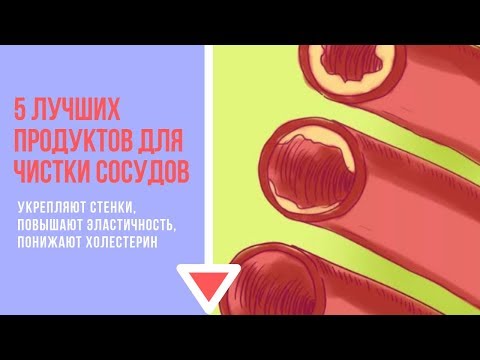 5 лучших продуктов для чистки сосудов