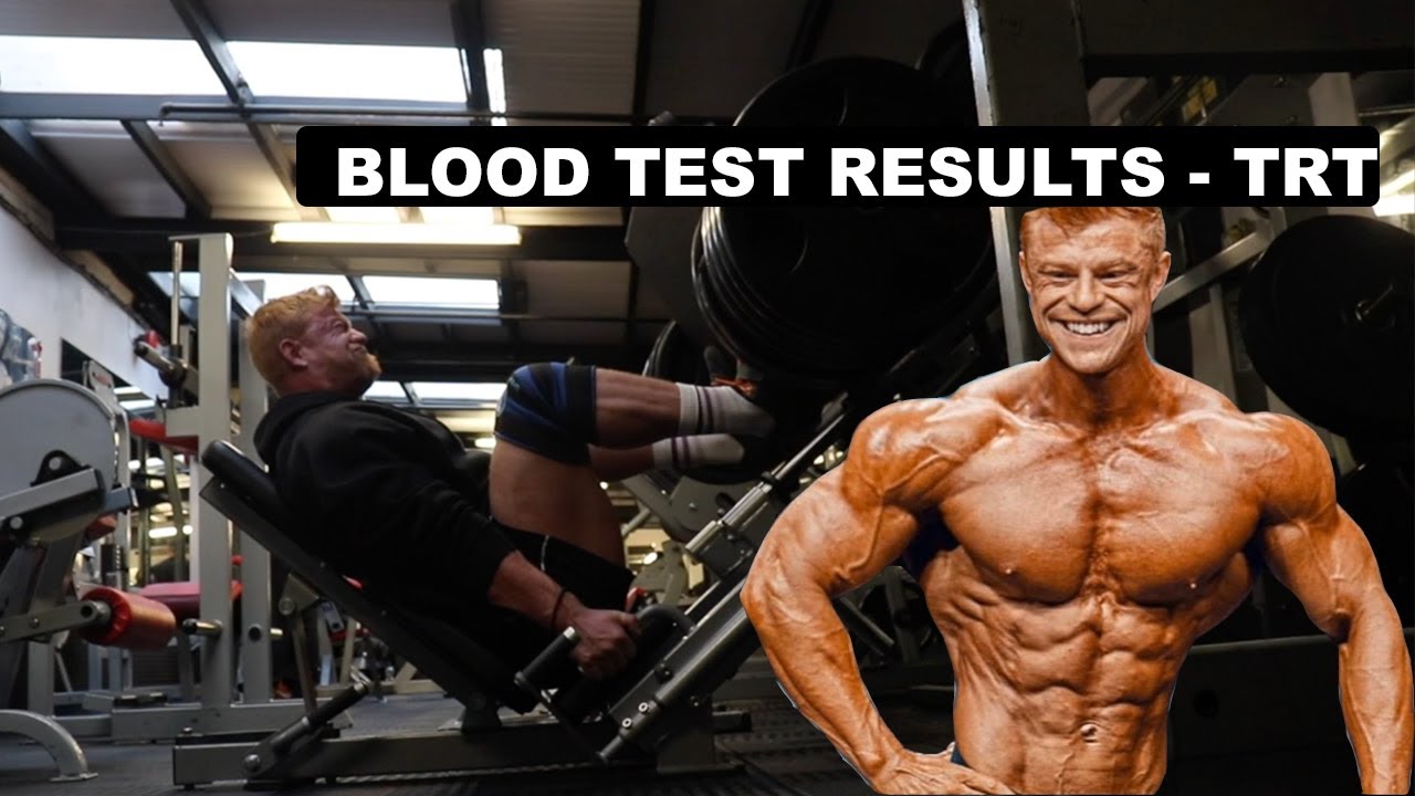 Full Blood Test Results 20 Weeks TRT Before Blast YouTube