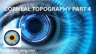CORNEAL TOPOGRAPHY PART 4: FOUR MAIN MAPS OF TOPOGRAPHY
